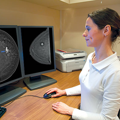Contrast Enhanced Mammography